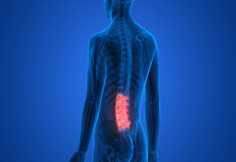 Vertebroplastia: avanço para tratar a coluna vertebral